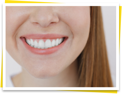 審美歯科は自費診療（保険適応外診療）となります。